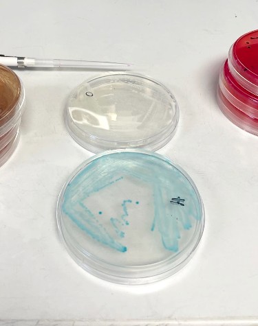 Petri dishes sit on a counter